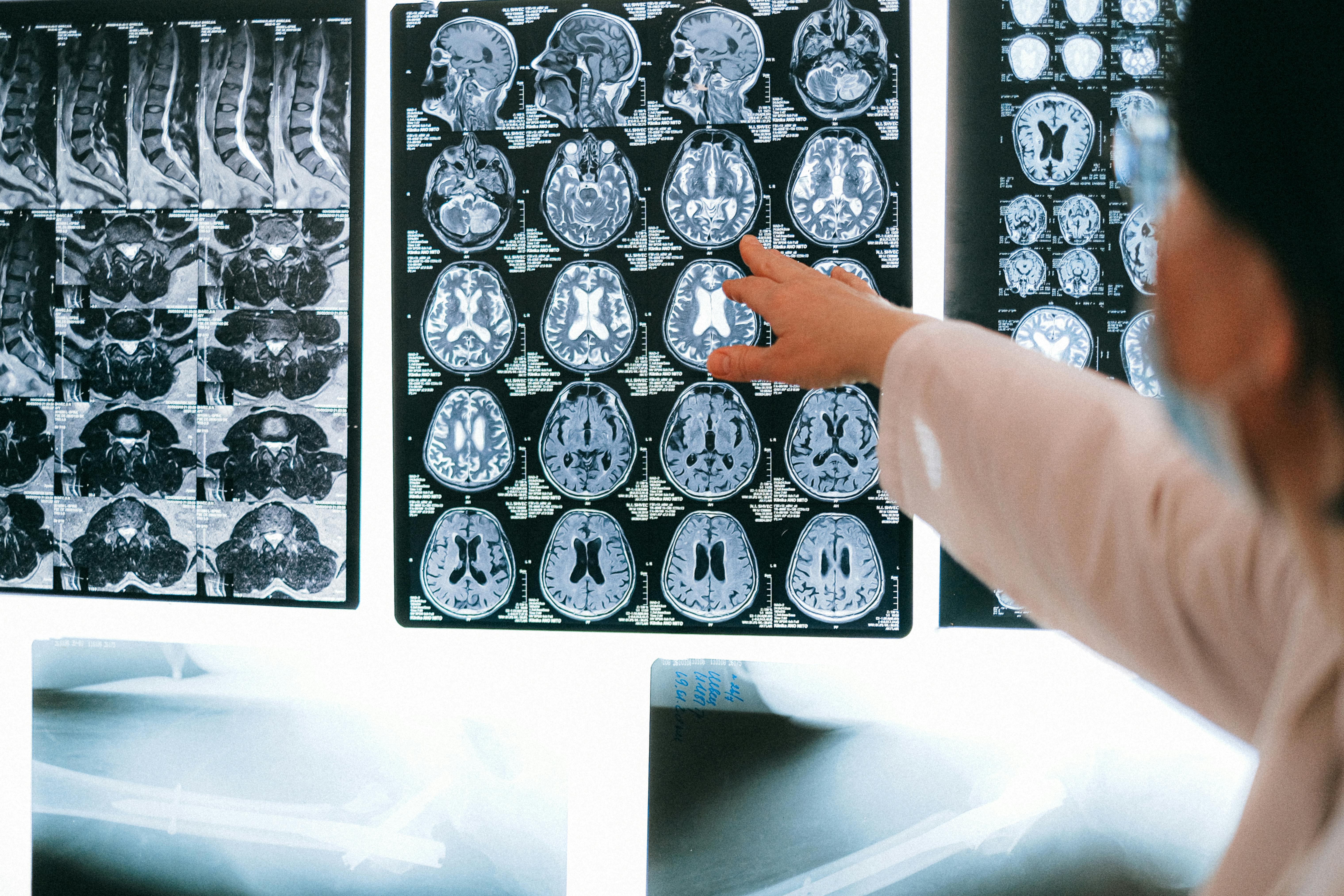 AI in Healthcare